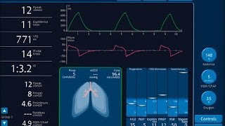 How does a ventilator works [upl. by Sakhuja]