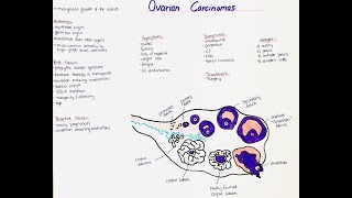 Ovarian Carcinomas  Histology Types Symptoms Diagnosis Risk Factors Treatment Prognosis [upl. by Ateekal]