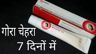 गोरा चेहरा सिर्फ 7 दिनों में Melalite 15 Cream Review Hindi [upl. by Laekcim191]