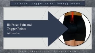 IlioPsoas Pain and Trigger Points [upl. by Lebana]