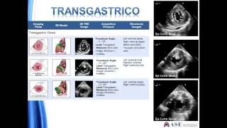 Guias para un examen de echocardiografia transesofagica integral [upl. by Artied]