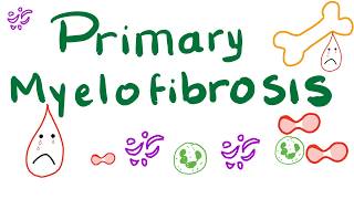 Primary Myelofibrosis PMF  Myeloproliferative Neoplasm Bone Marrow Fibrosis [upl. by Nnylyar125]