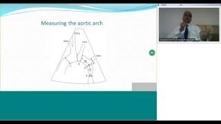 Diagnosis and Management of Coarctation of Aorta by Dr Suresh Kumar [upl. by Clementius]