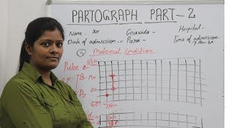 Partograph Part 2 in hindi  पार्टोग्राफ को कैसे भरे  Key Point of Partograph [upl. by Jestude]