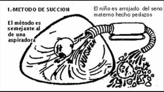 poema del aborto [upl. by Dickens234]