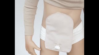 SenSura® Mio Kids 1piece Urostomy  how to use [upl. by Saiff]