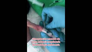 Las neonatólogas ¿qué opinan 😢😧 neonato prematuro pediatria [upl. by Auj397]