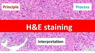 HE Staining Principle Procedure and Interpretation  Haematoxylin and Eosin Staining [upl. by Purington]