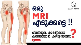 കാലിലേക്ക് ഇറങ്ങി വരുന്ന വേദന  Disc Bulge Sciatica Evidence based [upl. by Twitt]