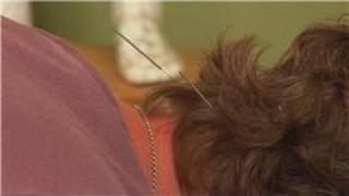 Acupuncture Treatments  Acupuncture for Neck Pain [upl. by Udenihc502]