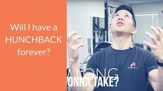 How long does it take to fix hunchback posture [upl. by Yelroc2]