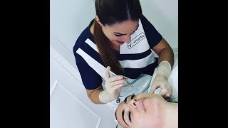 Tratamiento de Mesoterapia Facialpaso a paso en Clínica VIVANTANira Fayna [upl. by Ahsinar]