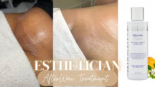 How To Treat Ingrowns amp Razor Bumps  After Brazilian Wax amp Vajacial Treatment Esthetician Tips [upl. by Mckinney]