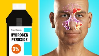 11 Benefits of Hydrogen Peroxide Most People Don’t Know [upl. by Annol]