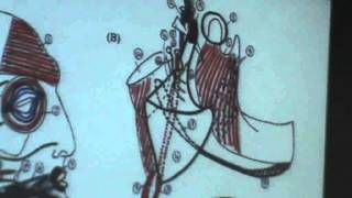 5 DrAhmed Galal 19102014  Parotid gland [upl. by Knah]