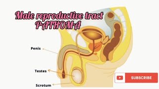 Male genital tract pathology Pathoma 2Testicular tumors [upl. by Feledy460]