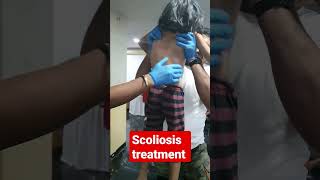 scoliosis treatment 93085113578409313131 [upl. by Malliw5]