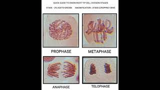 Stages of prophase1 in meiosis [upl. by Lytle]