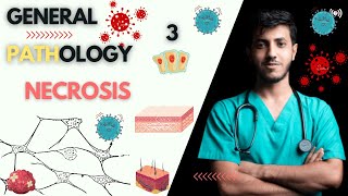 General Pathology Course  lecture 1  part 3  Necrosis  كورس علم الأمراض [upl. by Eetnahs633]