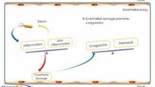 Sepsis development and progression [upl. by Meeka]