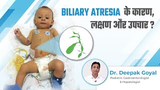 Biliary Atresia के कारण लक्षण और उपचार  Biliary Atresia Baby  Dr Deepak Goyal [upl. by Ibrab724]