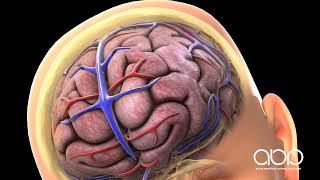 Concussion and Bleeding On The Brain [upl. by Vaden]