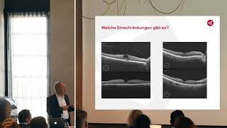 Welche Rolle spielt die OCTAngiografie in der Glaukomdiagnostik – Dr Karsten Klabe Vortrag [upl. by Aleb479]