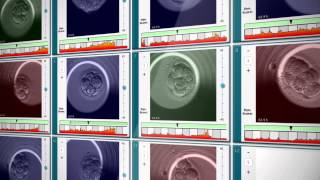 EmbryoScope® Timelapse System [upl. by Ayihsa]