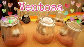 How to Ventosa at Home  Cupping Therapy  Ventosa Procedure [upl. by Bohner]