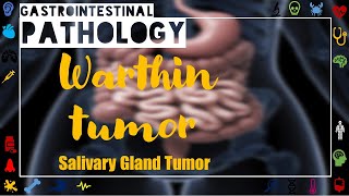 Warthin Tumor Pathology and MorphologySalivary Gland TumorsGI Pathology [upl. by Nyllek]