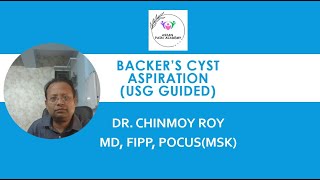 Backer’s Cyst Aspiration under Ultrasound [upl. by Yadrahc]