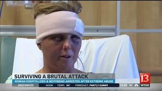 Domestic violence victim shares story of exboyfriend attack after he nearly ripped out her tongue [upl. by Bushweller]