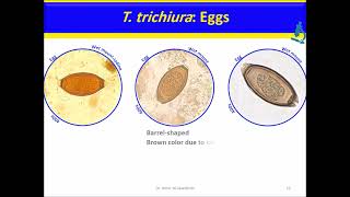 Trichuris trichiura Nematodes [upl. by Hughmanick]