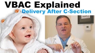 VBACTOLAC Explained Everything about delivery after csection [upl. by Nylavad]