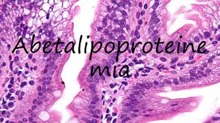 How to Pronounce Abetalipoproteinemia [upl. by Tiena]