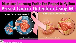 Data Science amp Machine Learning Project  Breast Cancer Prediction using PyCaret ✅ [upl. by Aihtibat515]