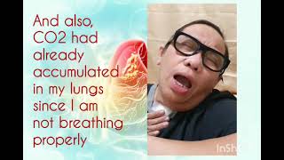 Pulmonary Rehabilitation Testimonial from Region VI Iloilo [upl. by Adnalram790]