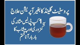 Health Tips  Frequent Urine Problem In Male And Female  Bar Bar Peshab Aane Ka Ilaj In Urdu [upl. by Dyer732]