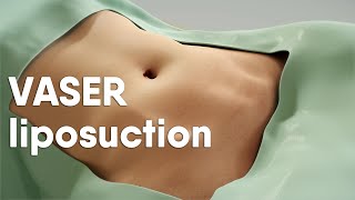 VASER liposuction is also called ultrasoundassisted liposuction VASER lipo or LipoSculpting [upl. by Outlaw447]