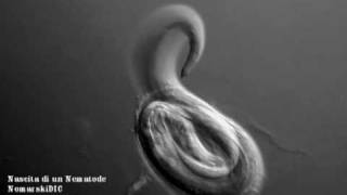 Nematode birth [upl. by Lj]