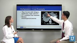 Causes of High Calcium  Masha Livhits MD amp Michael Yeh MD  UCLAMDChat [upl. by Furlong]