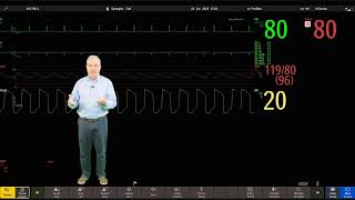 Philips IntelliVue Patient Monitoring  3  Main Screen Display [upl. by Lila]