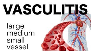 Vasculitis [upl. by Timmi]