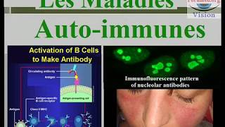 Les Maladies autoimmunes et les Vascularites [upl. by Shyamal]