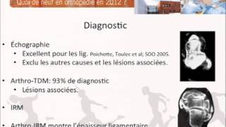 Ligamentoplastie cheville clinique du sport Dr CORDIER [upl. by Nahtaoj]