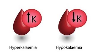 Hypokalemia VS Hyperkalemia [upl. by Rattan7]