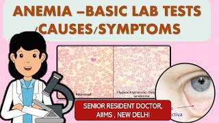 ANEMIA BASIC LAB TESTS  ANIMATED VIDEO [upl. by Auhsej]