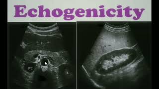 Echogenicity Ultrasound ultrasoundecgogenicity sonology [upl. by Hijoung]