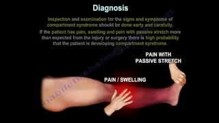 Compartment SyndromeDiagnosisPressuresFasciotomy Everything You Need To Know Dr Nabil Ebraheim [upl. by Acino]