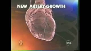 ABC News Clip Zhittya Regenerative Angiogenesis Drug [upl. by Naval]